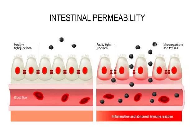 Intestinal permeability
