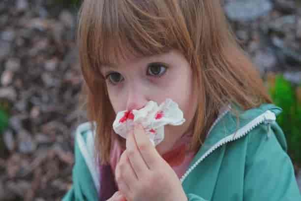 When to worry about a nosebleed