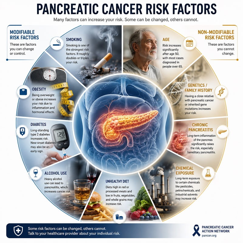 Infographic showing pancreatic cancer risk factors including smoking, diabetes, obesity, and genetics